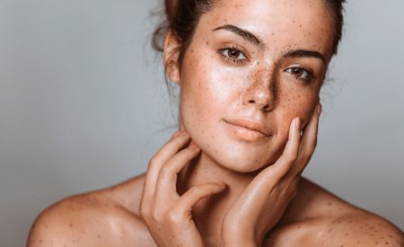 Diffuse Pigmentation